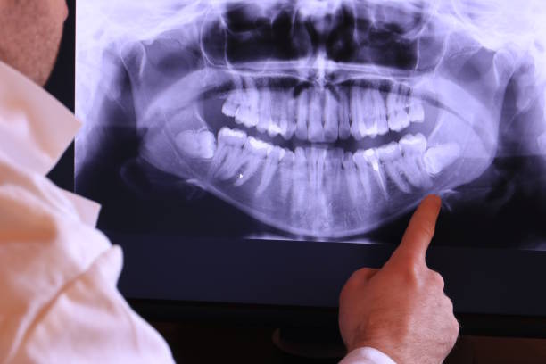 Best Emergency Treatment for Dental Infections or Abscesses in Richwood, OH